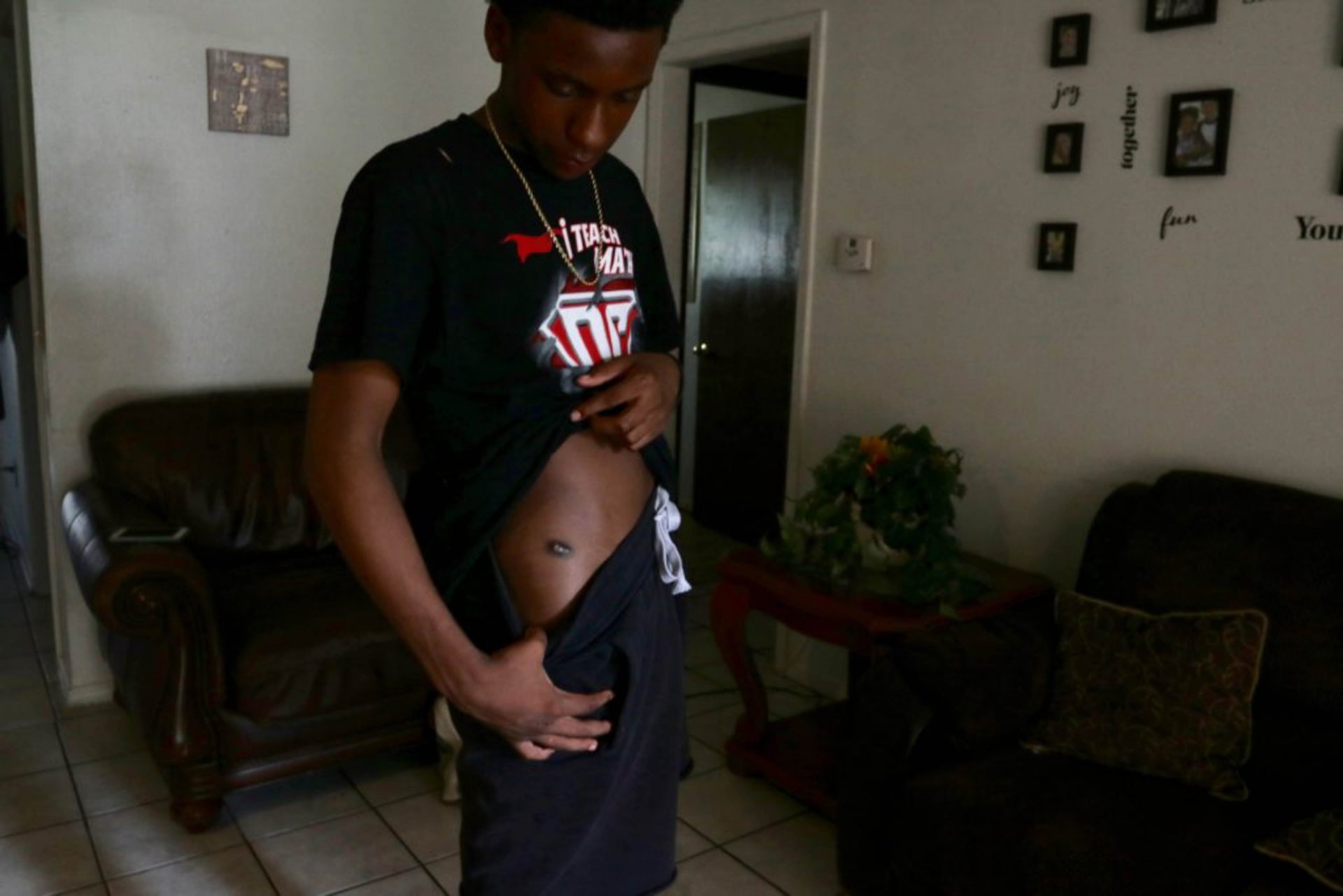 Lorenzo Clerkley moves his clothes to show a bullet wound in his thigh.